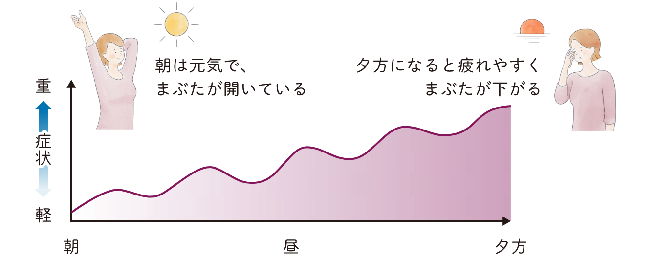 症状の特徴は？ 日内変動のイメージ